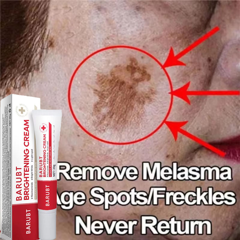 Vitamin C Serum Face - Powerful Spot-removing Whitening Cream Brighten Skin