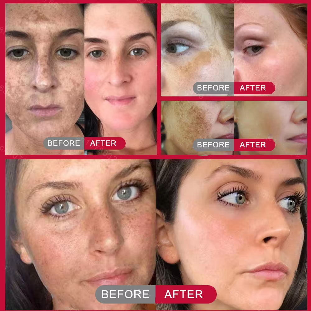 Powerful Spot-removing Whiteni - Vitamin C Serum Face recension och pris